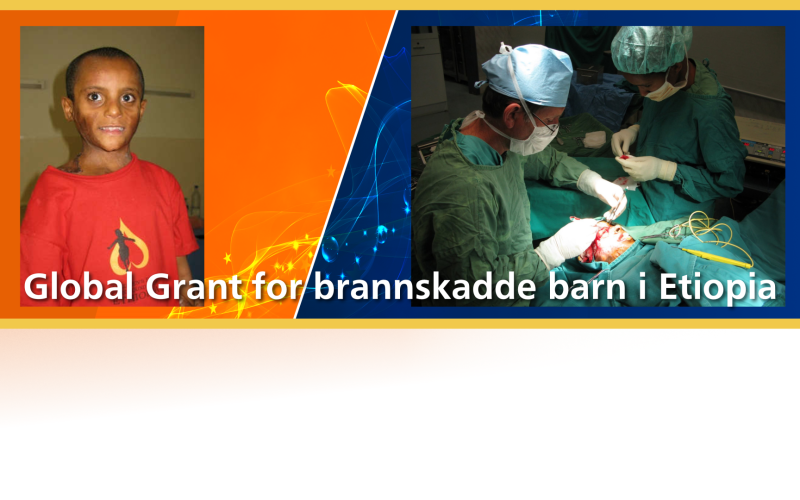 Harstad Rotaryklubb med stort Global Grant